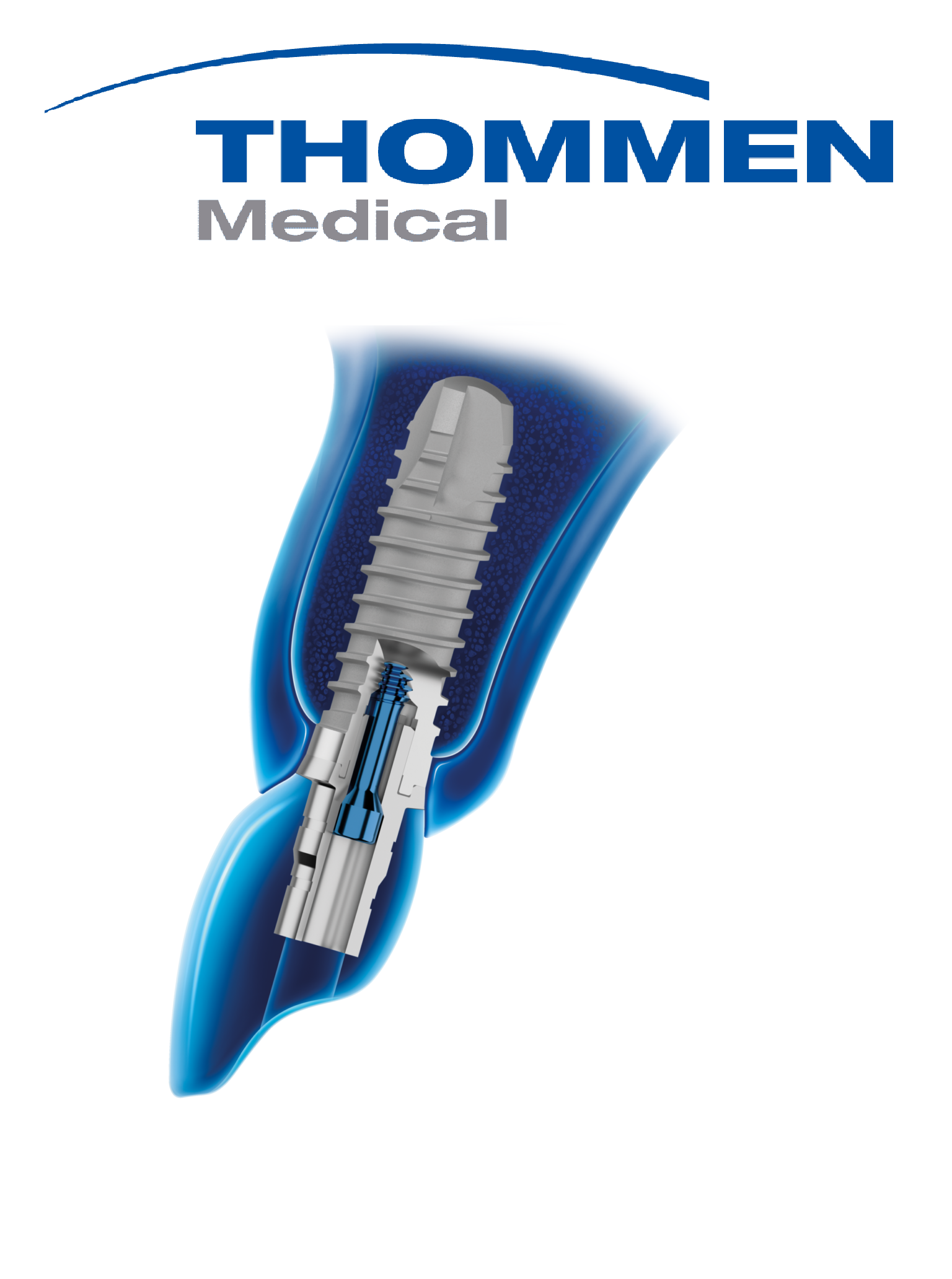 Implanty stomatologiczne Szczecin